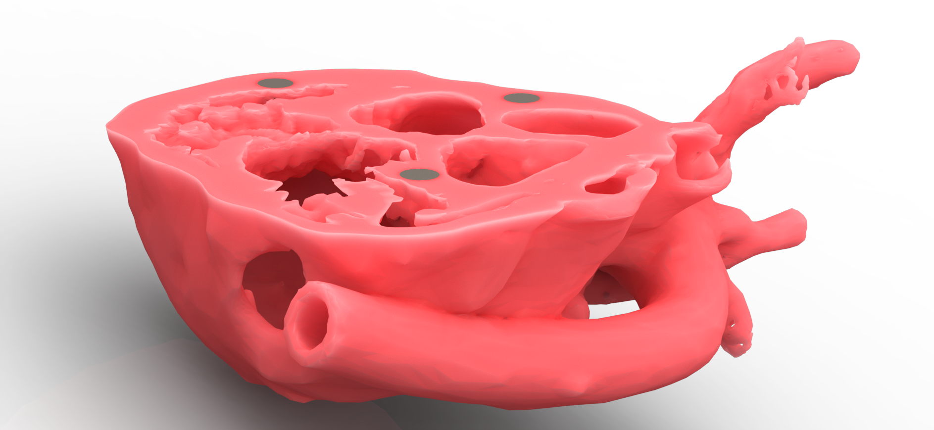 3D Printed Heart Section 3 of 3