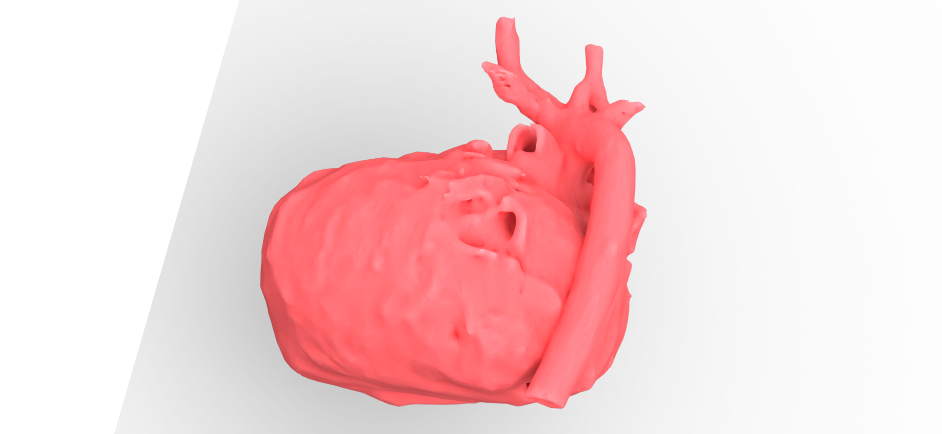 Human Heart