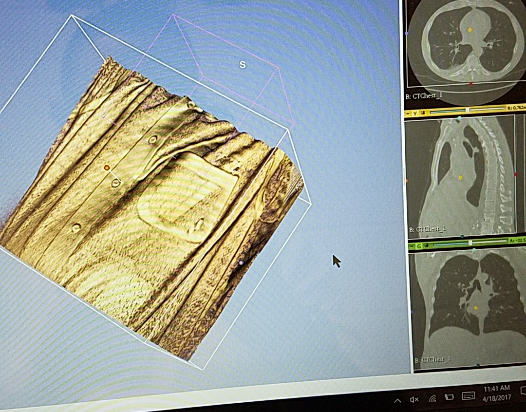Human Torso Clothing CT Scan (Sample)