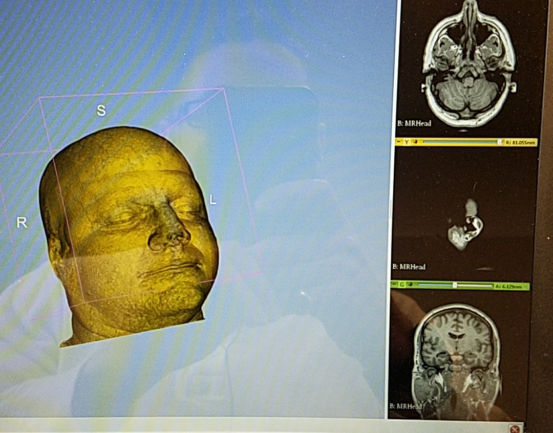 Human Head MRI Scan (Sample)