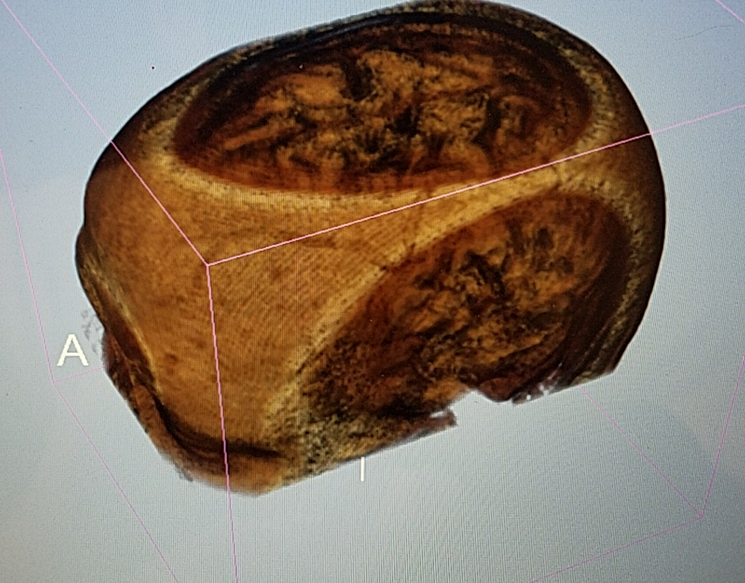 Human Skull MRI Scan (Sample)
