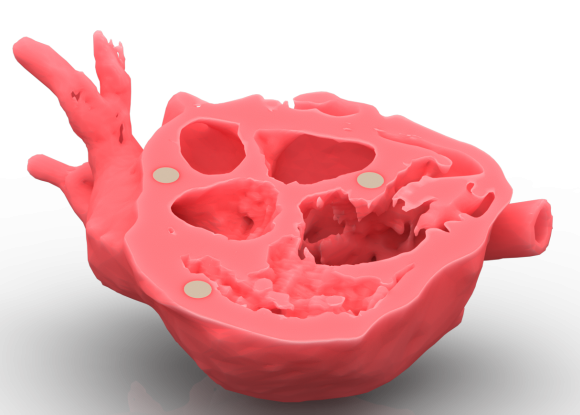 3D Printed Heart Section 1 of 3