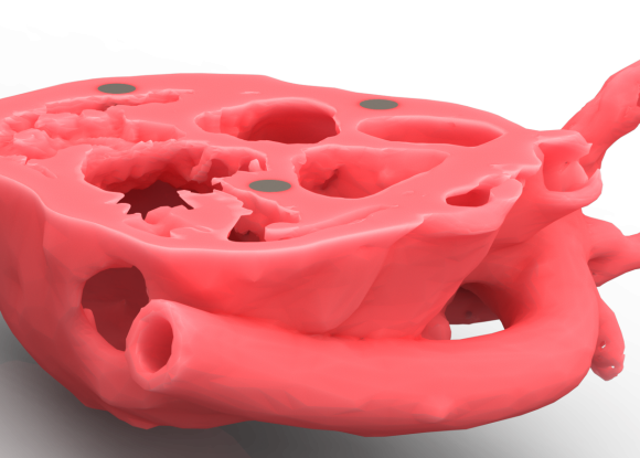 3D Printed Heart Section 3 of 3
