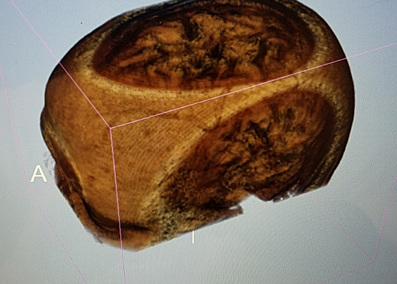 Human Skull MRI Scan (Sample)